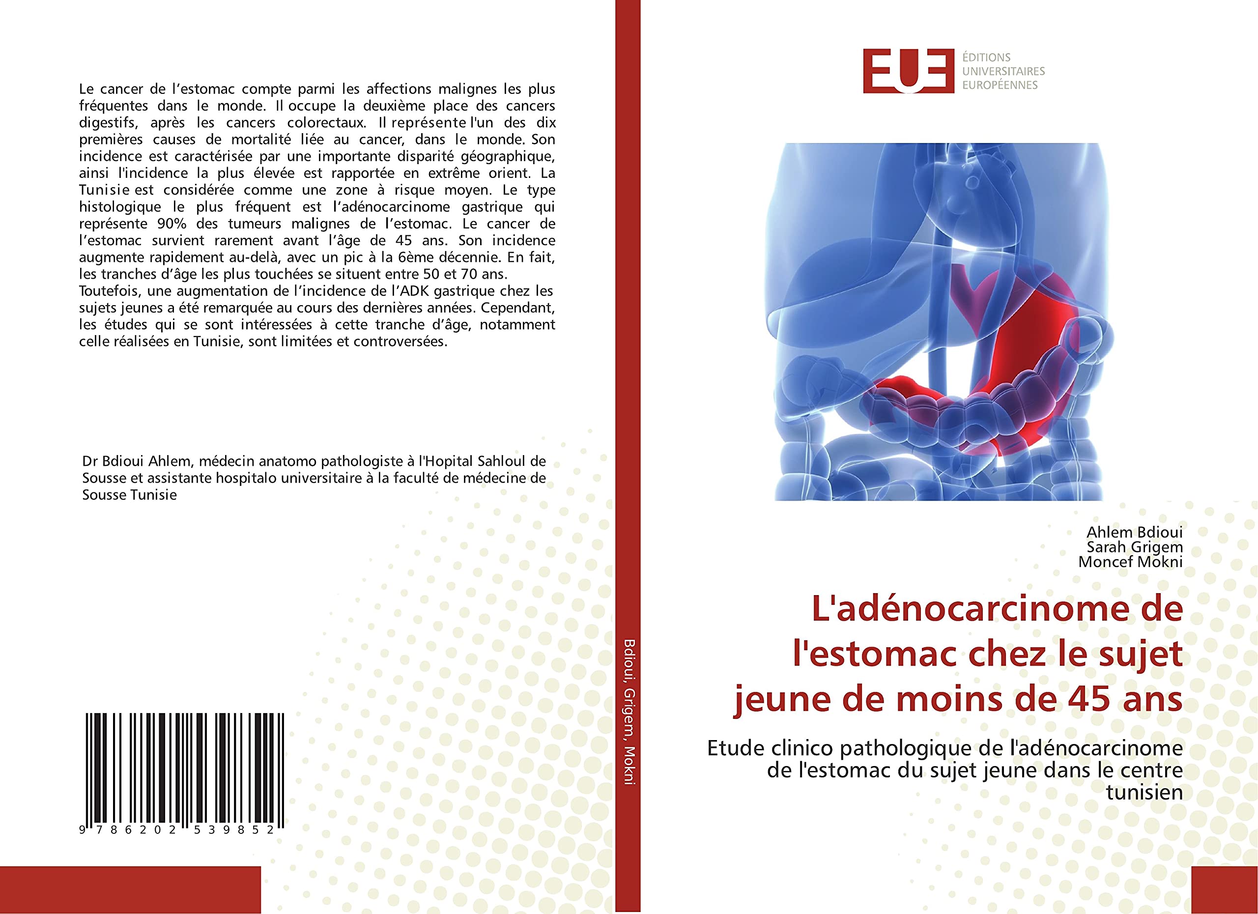 L'adénocarcinome de l'estomac chez le sujet jeune de moins de 45 ans: Etude clinico pathologique de l'adénocarcinome de l'estomac du sujet jeune dans le centre tunisien book