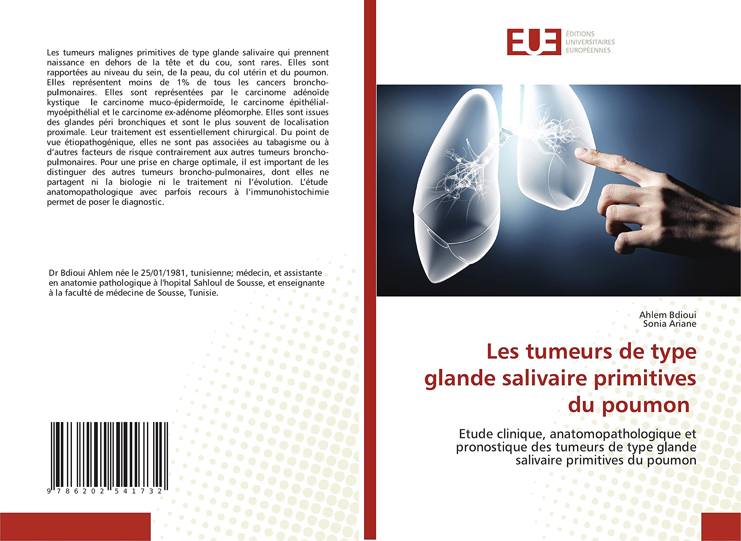 Les tumeurs de type glande salivaire primitives du poumon: Etude clinique, anatomopathologique et pronostique des tumeurs de type glande salivaire primitives du poumon book