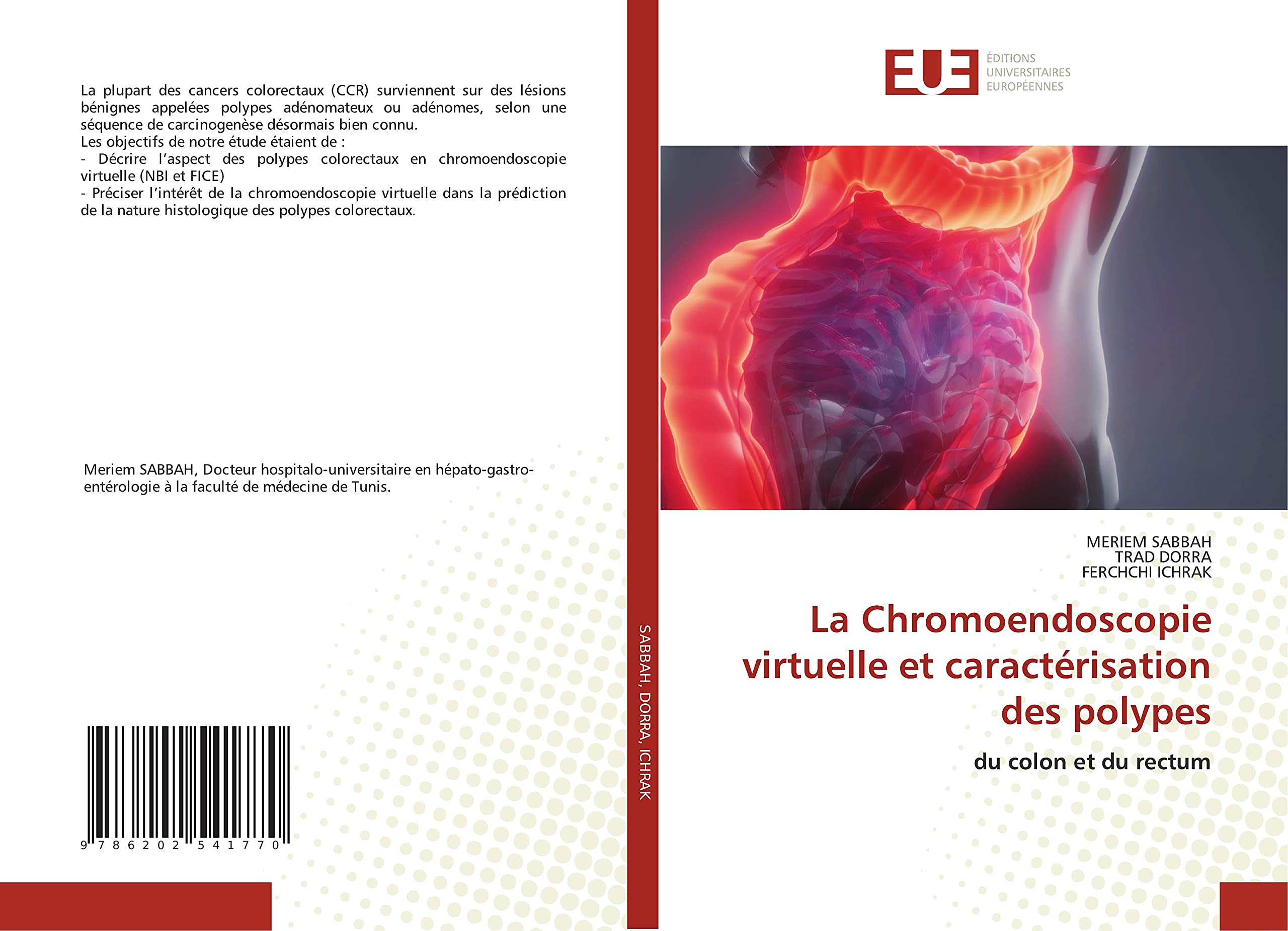 La Chromoendoscopie virtuelle et caractérisation des polypes: du colon et du rectum book