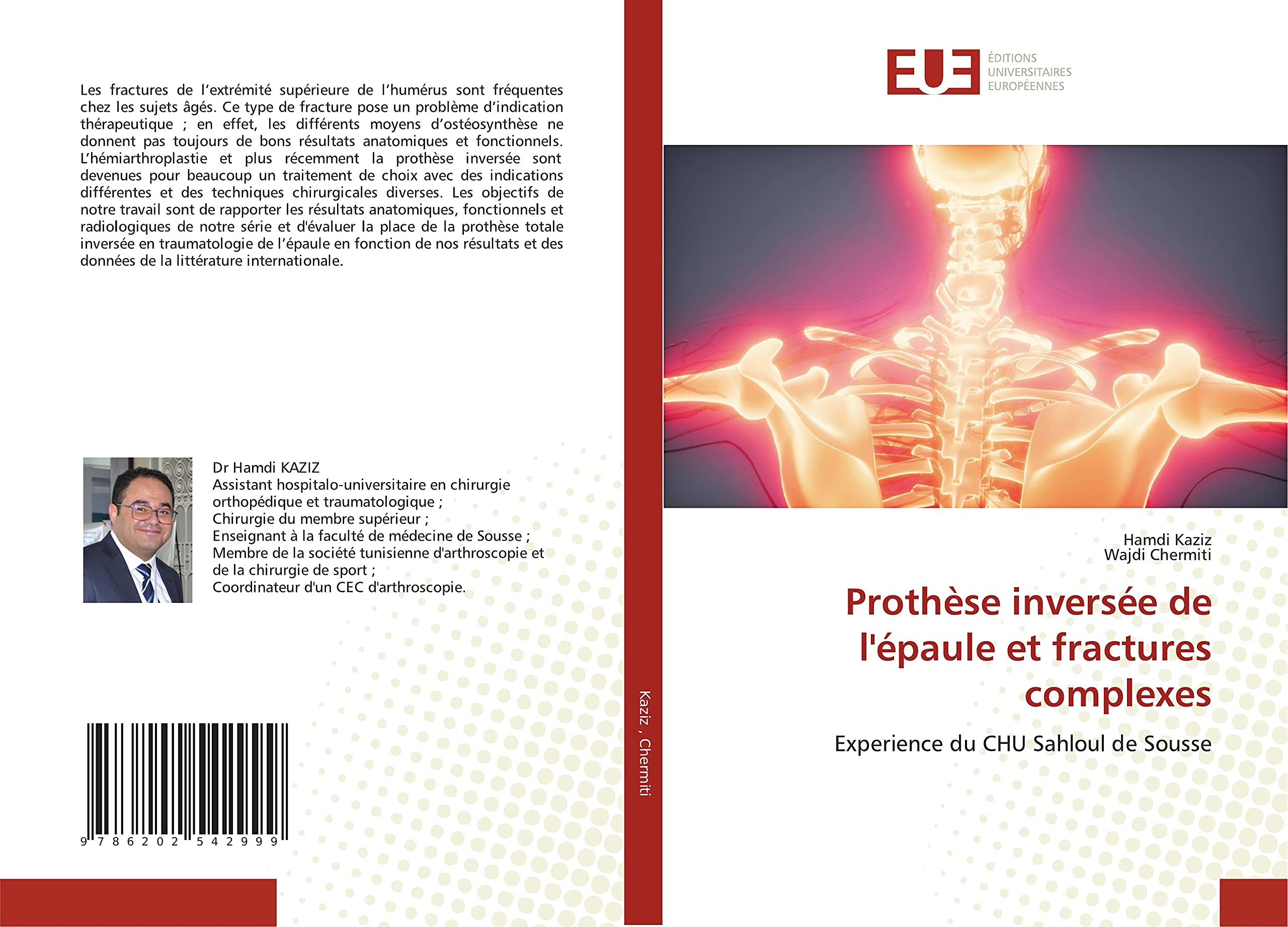 Prothèse inversée de l'épaule et fractures complexes: Experience du CHU Sahloul de Sousse book