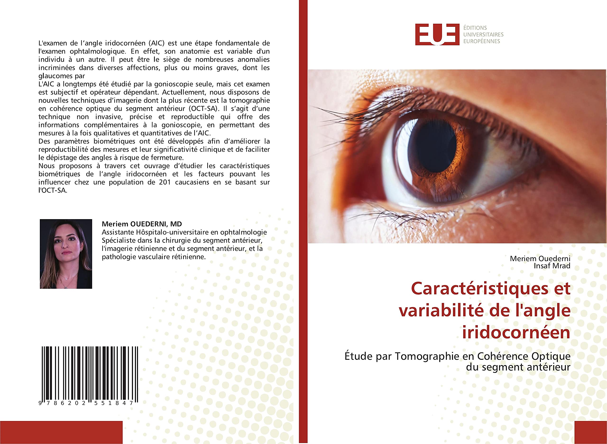 Caractéristiques et variabilité de l'angle iridocornéen: Étude par Tomographie en Cohérence Optique du segment antérieur book