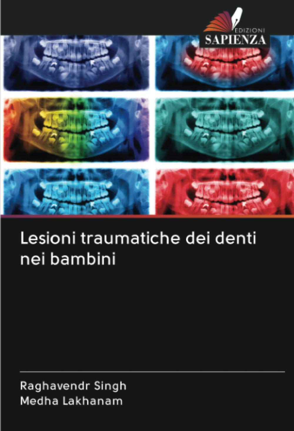 Lesioni traumatiche dei denti nei bambini Medicine