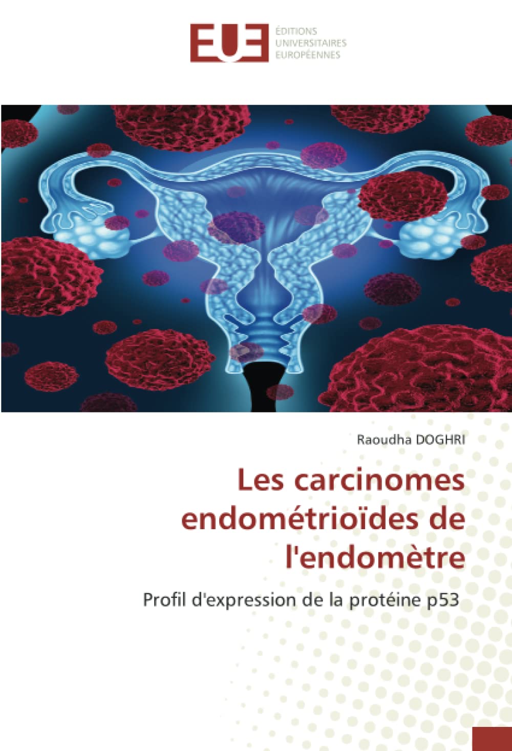 Les carcinomes endométrioïdes de l'endomètre: Profil d'expression de la protéine p53 book