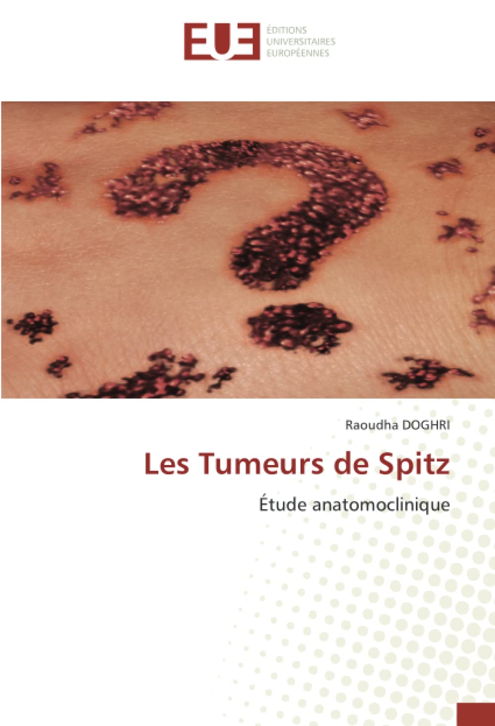 Les Tumeurs de Spitz: Étude anatomoclinique book