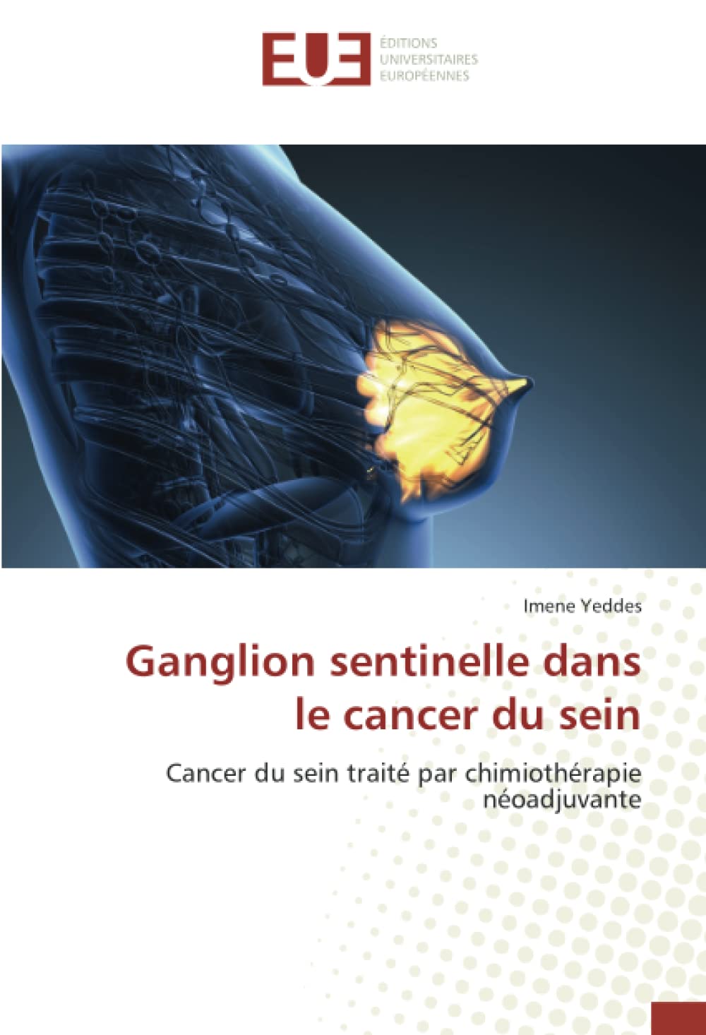 Ganglion sentinelle dans le cancer du sein: Cancer du sein traité par chimiothérapie néoadjuvante book