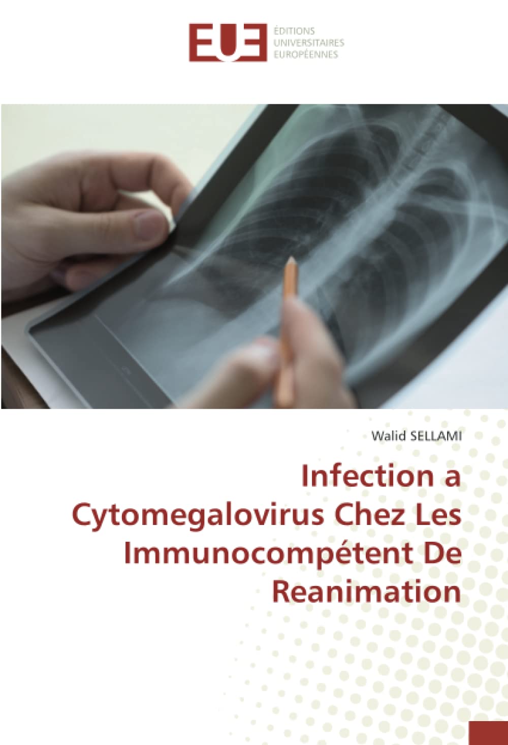 Infection a Cytomegalovirus Chez Les Immunocompétent De Reanimation book