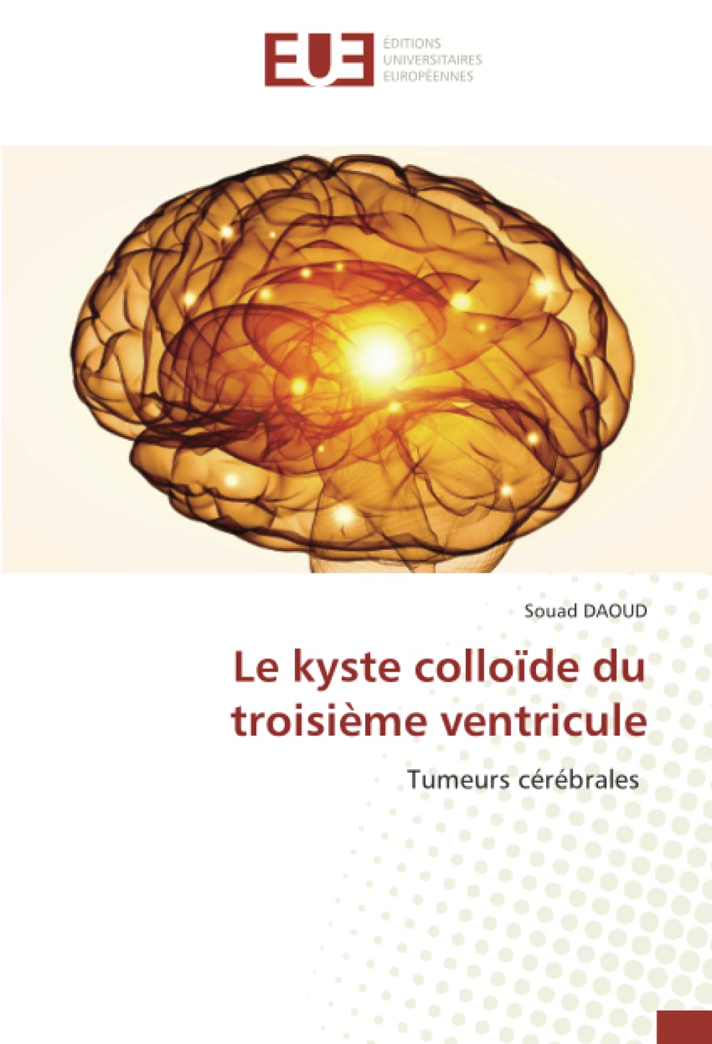 Le kyste colloïde du troisième ventricule: Tumeurs cérébrales book