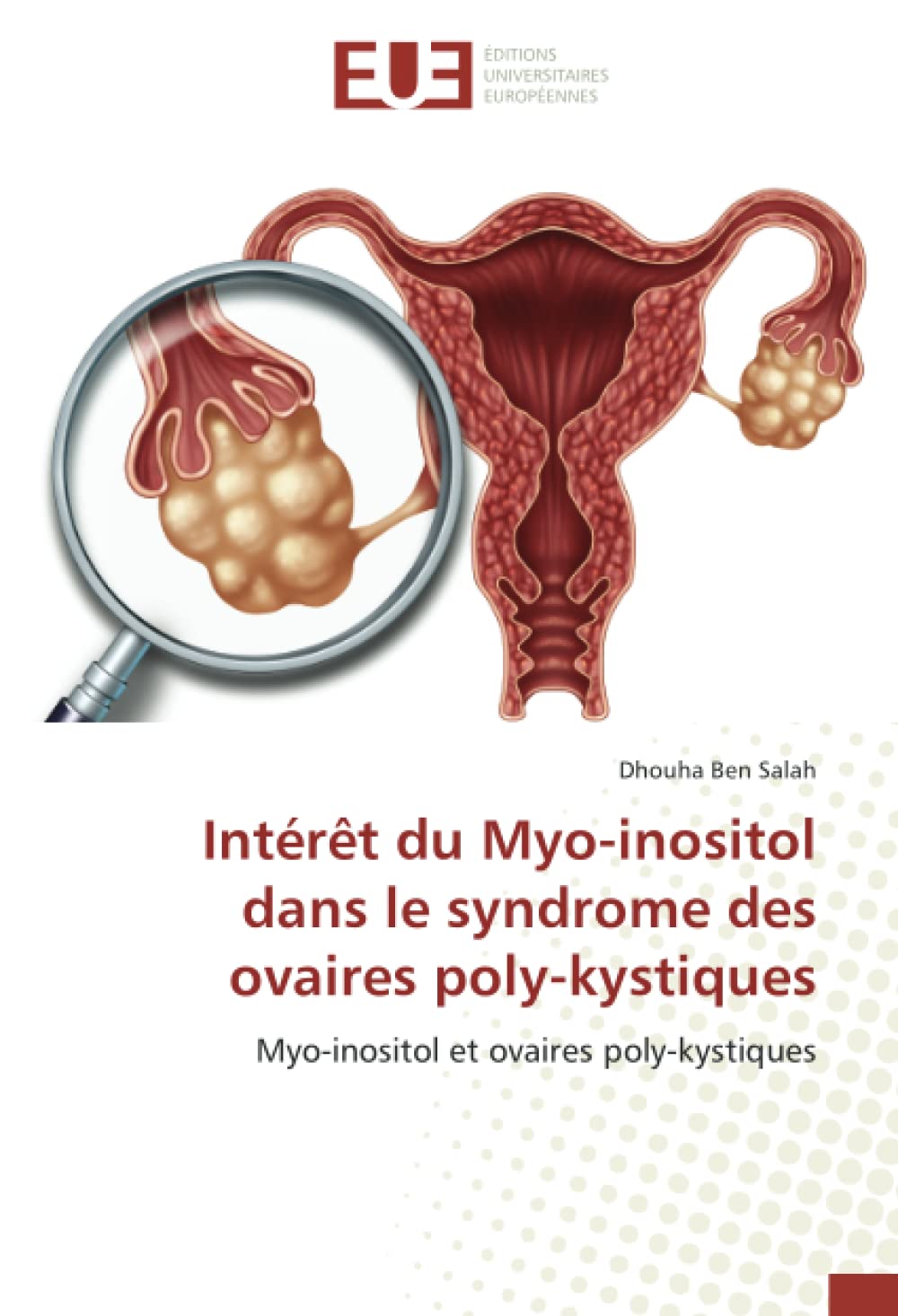 Intérêt du Myo-inositol dans le syndrome des ovaires poly-kystiques: Myo-inositol et ovaires poly-kystiques book