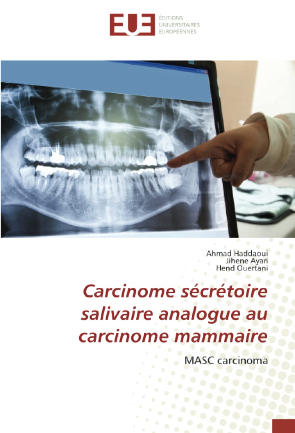 Carcinome sécrétoire salivaire analogue au carcinome mammaire: MASC carcinoma book