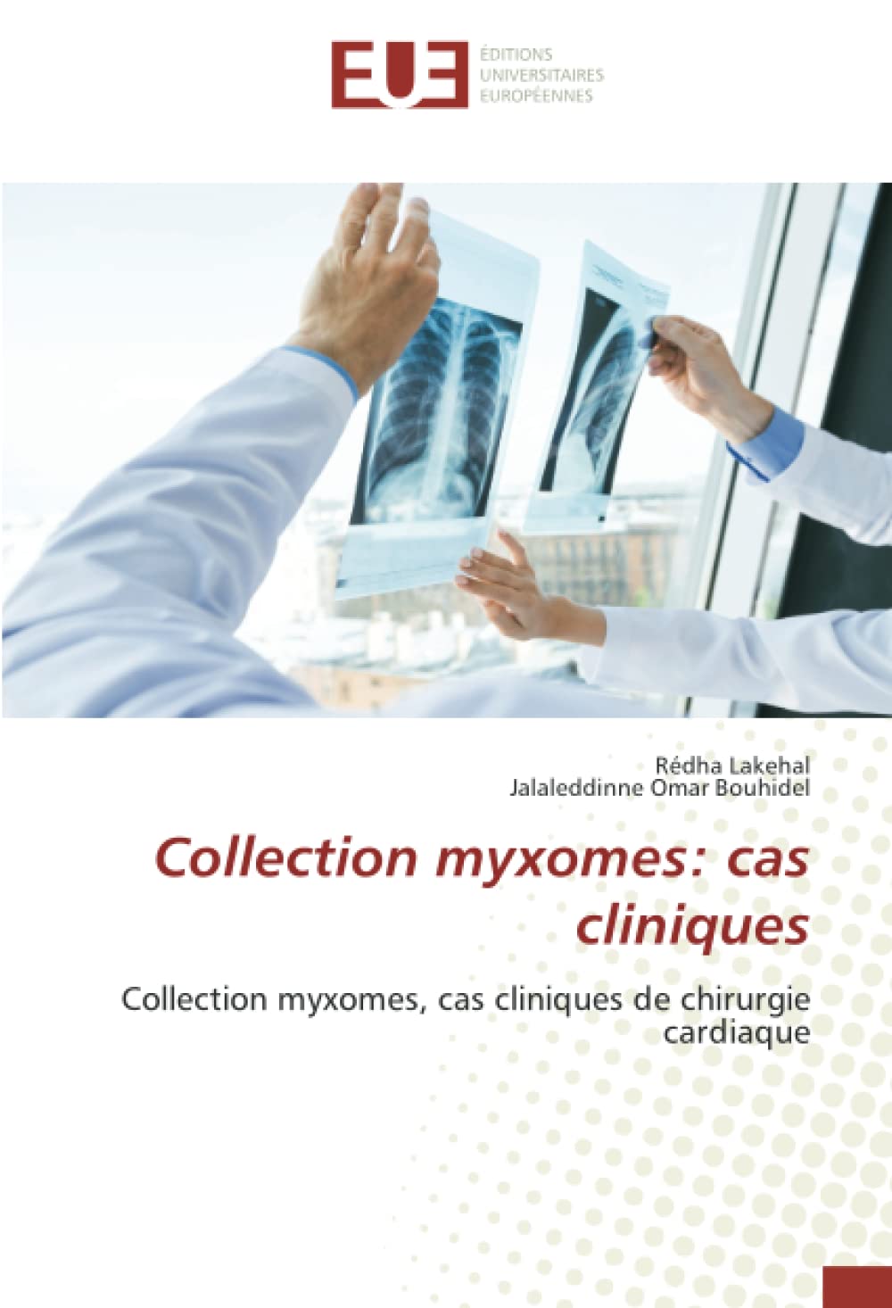 Collection myxomes: cas cliniques: Collection myxomes, cas cliniques de chirurgie cardiaque book