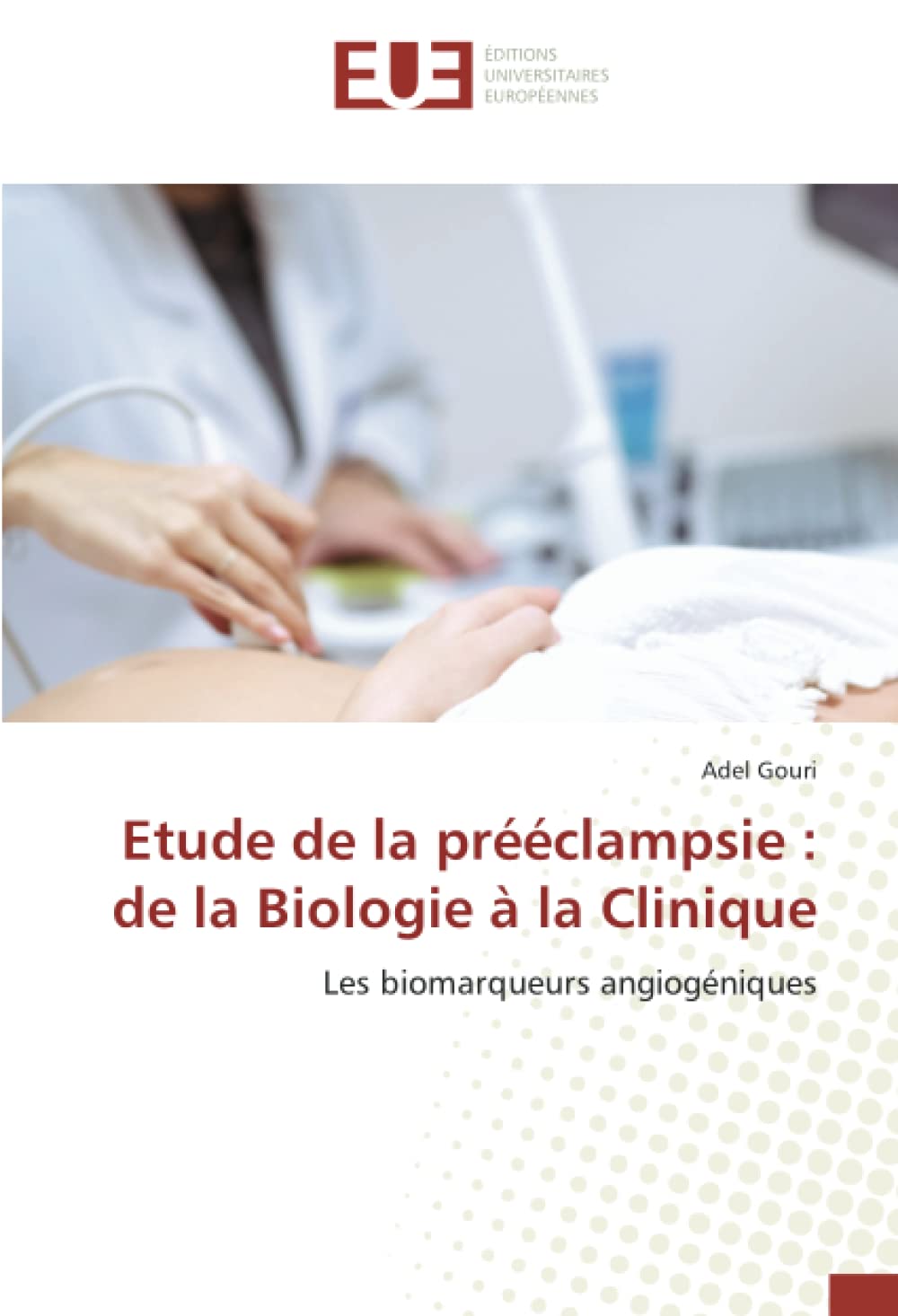 Etude de la prééclampsie : de la Biologie à la Clinique: Les biomarqueurs angiogéniques book