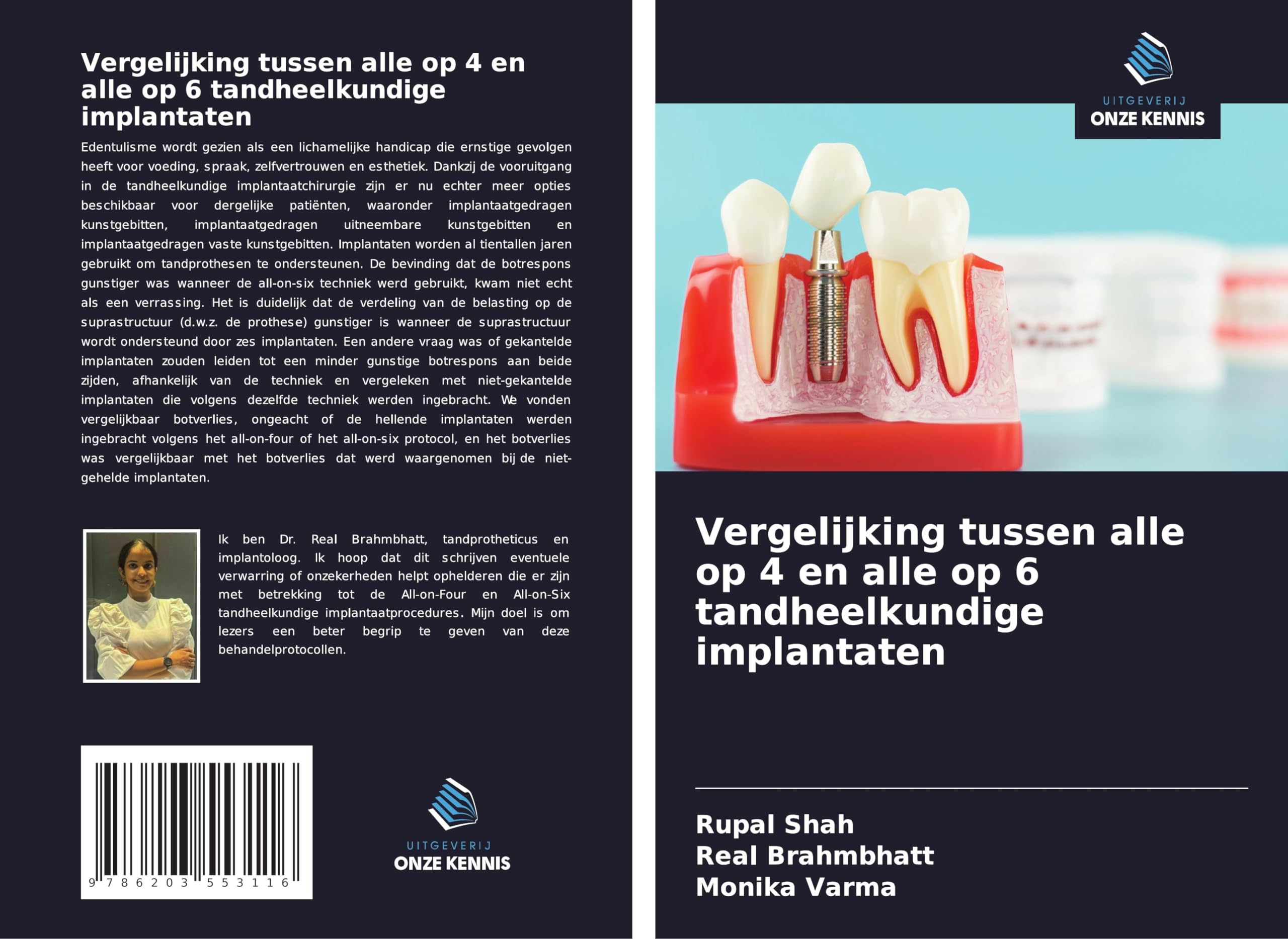 Vergelijking tussen alle op 4 en alle op 6 tandheelkundige implantaten Medicine