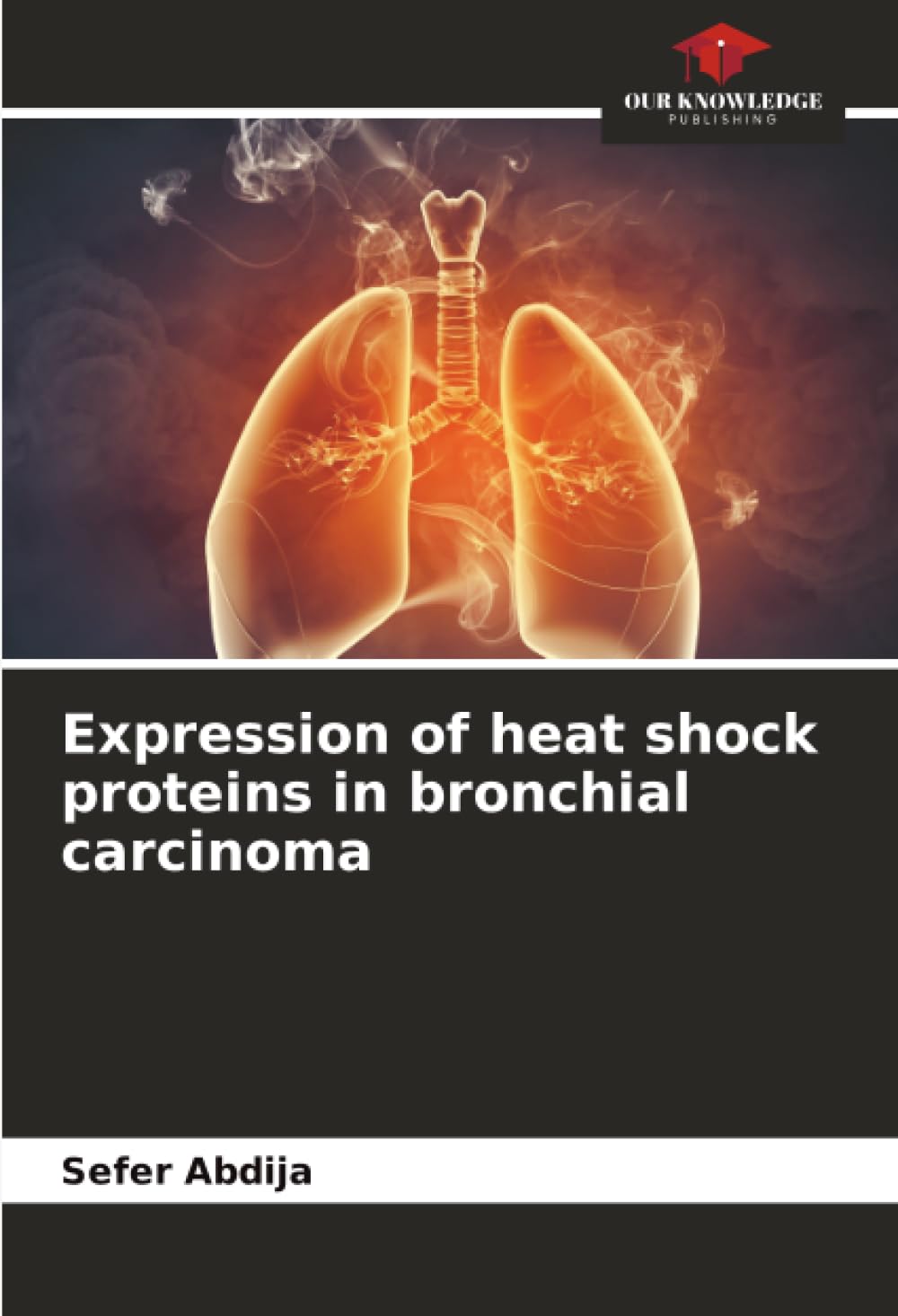 Expression of heat shock proteins in bronchial carcinoma Business & Technology