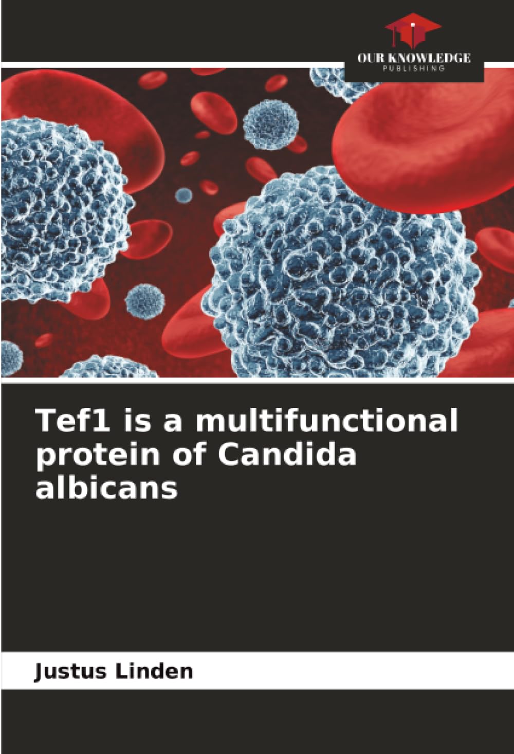 Tef1 is a multifunctional protein of Candida albicans Medicine