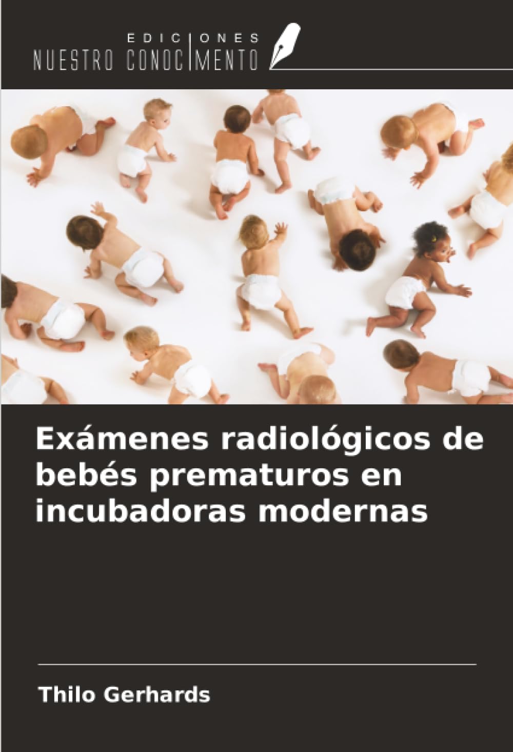 Exámenes radiológicos de bebés prematuros en incubadoras modernas Medicine