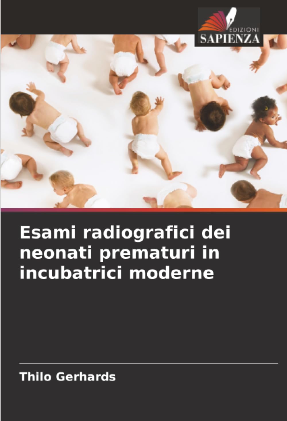 Esami radiografici dei neonati prematuri in incubatrici moderne Medicine
