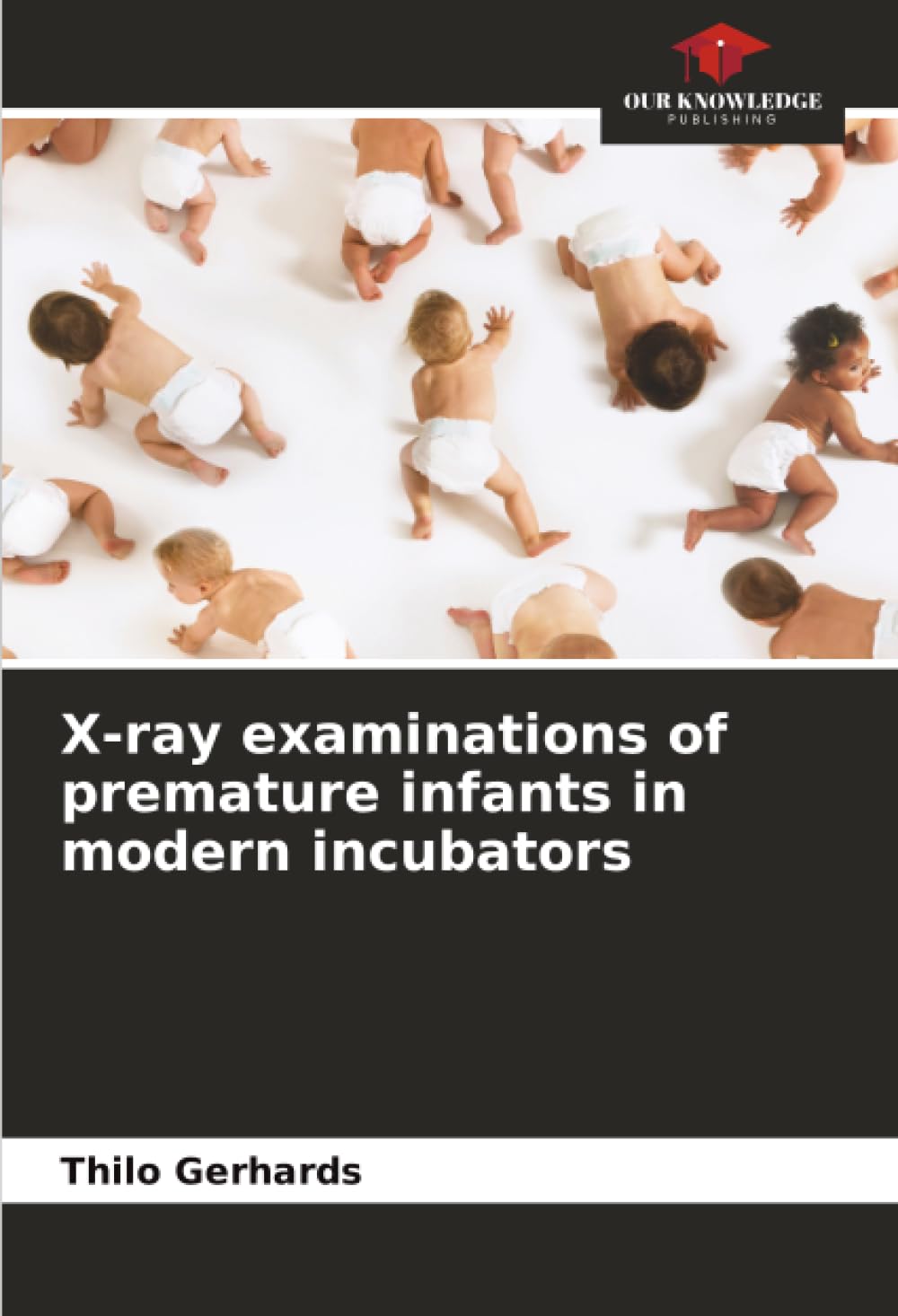 X-ray examinations of premature infants in modern incubators Medicine