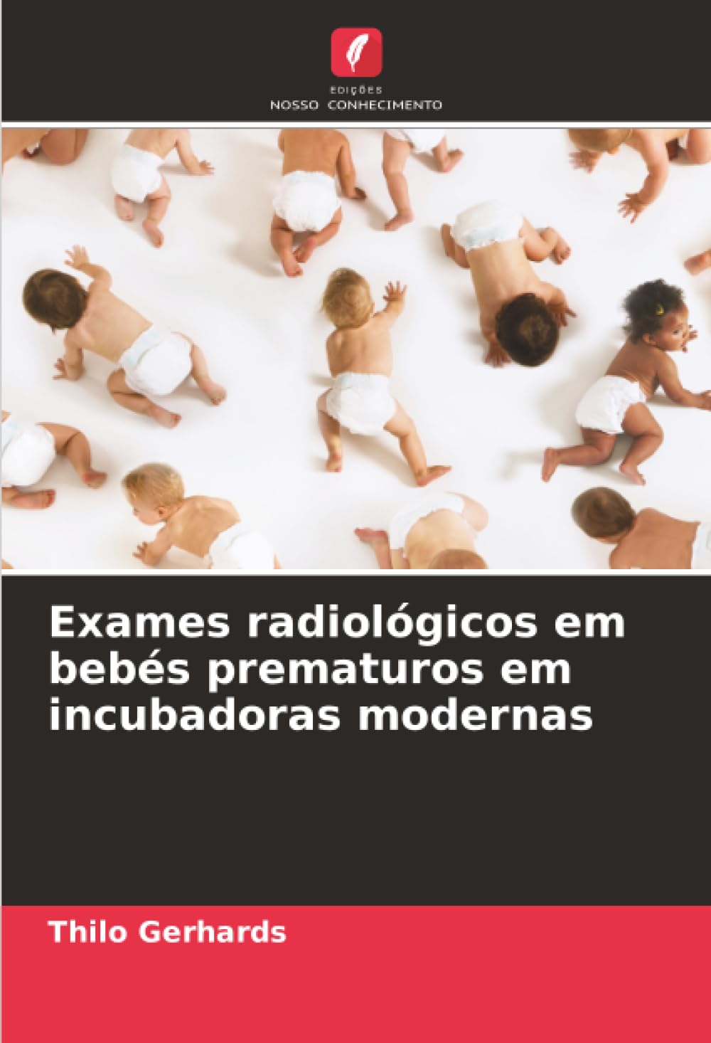 Exames radiológicos em bebés prematuros em incubadoras modernas Medicine