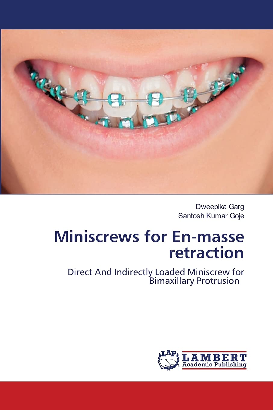 Miniscrews for En-masse retraction: Direct And Indirectly Loaded Miniscrew for Bimaxillary Protrusion Medicine