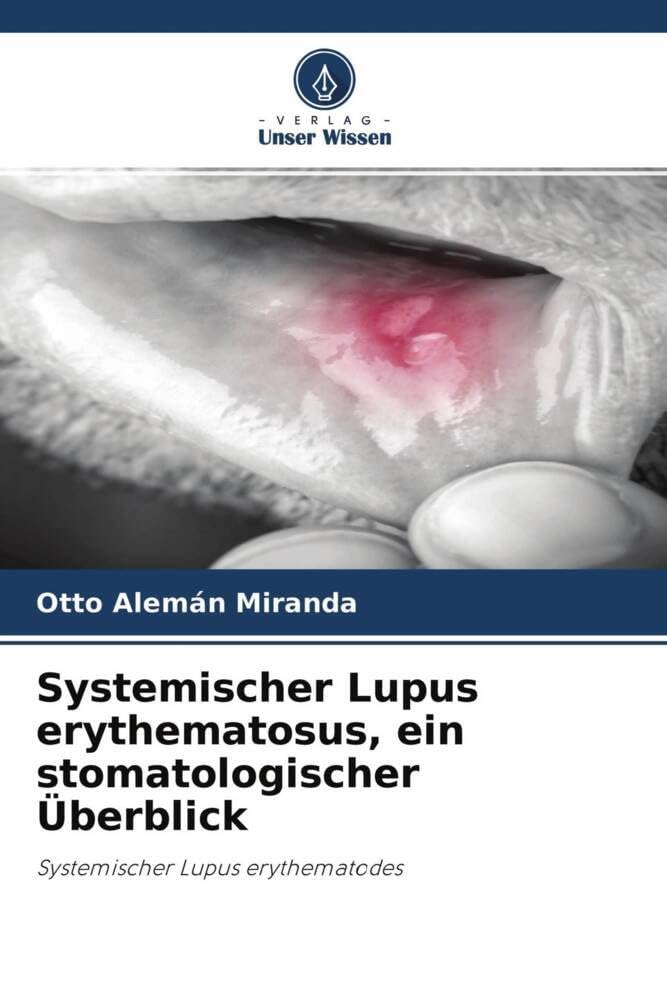 Systemischer Lupus erythematosus, ein stomatologischer Überblick: Systemischer Lupus erythematodes Medicine
