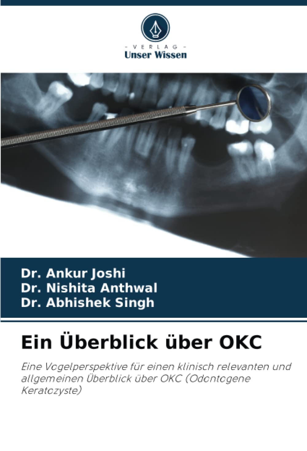 Ein Überblick über OKC: Eine Vogelperspektive für einen klinisch relevanten und allgemeinen Überblick über OKC (Odontogene Keratozyste) Medicine
