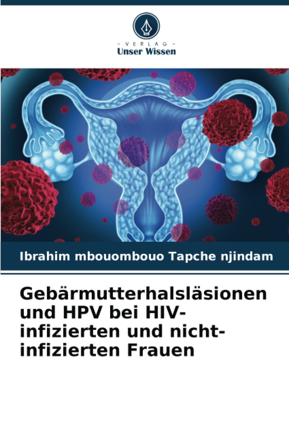 Gebärmutterhalsläsionen und HPV bei HIV-infizierten und nicht-infizierten Frauen: DE Medicine