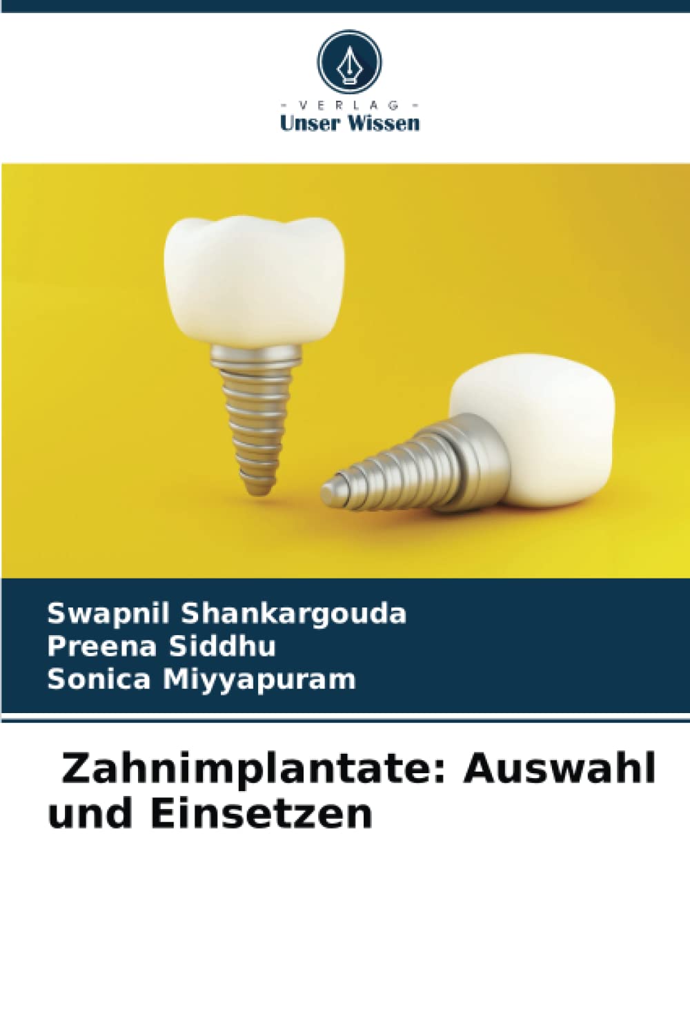 Zahnimplantate: Auswahl und Einsetzen Medicine