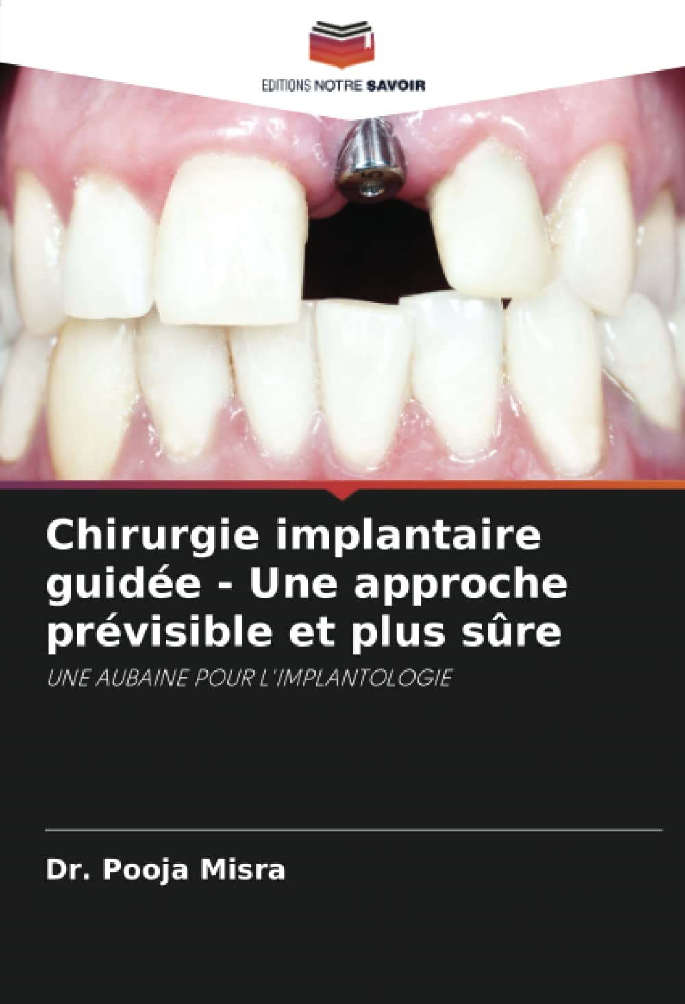 Chirurgie implantaire guidée - Une approche prévisible et plus sûre: UNE AUBAINE POUR L'IMPLANTOLOGIE book