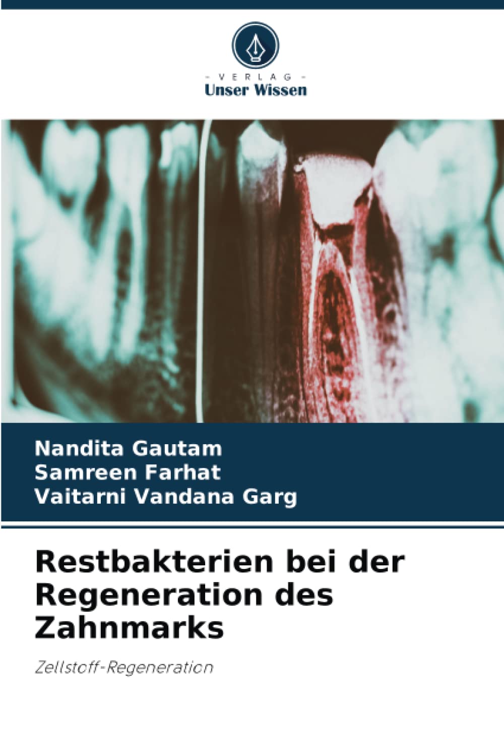 Restbakterien bei der Regeneration des Zahnmarks: Zellstoff-Regeneration Medicine