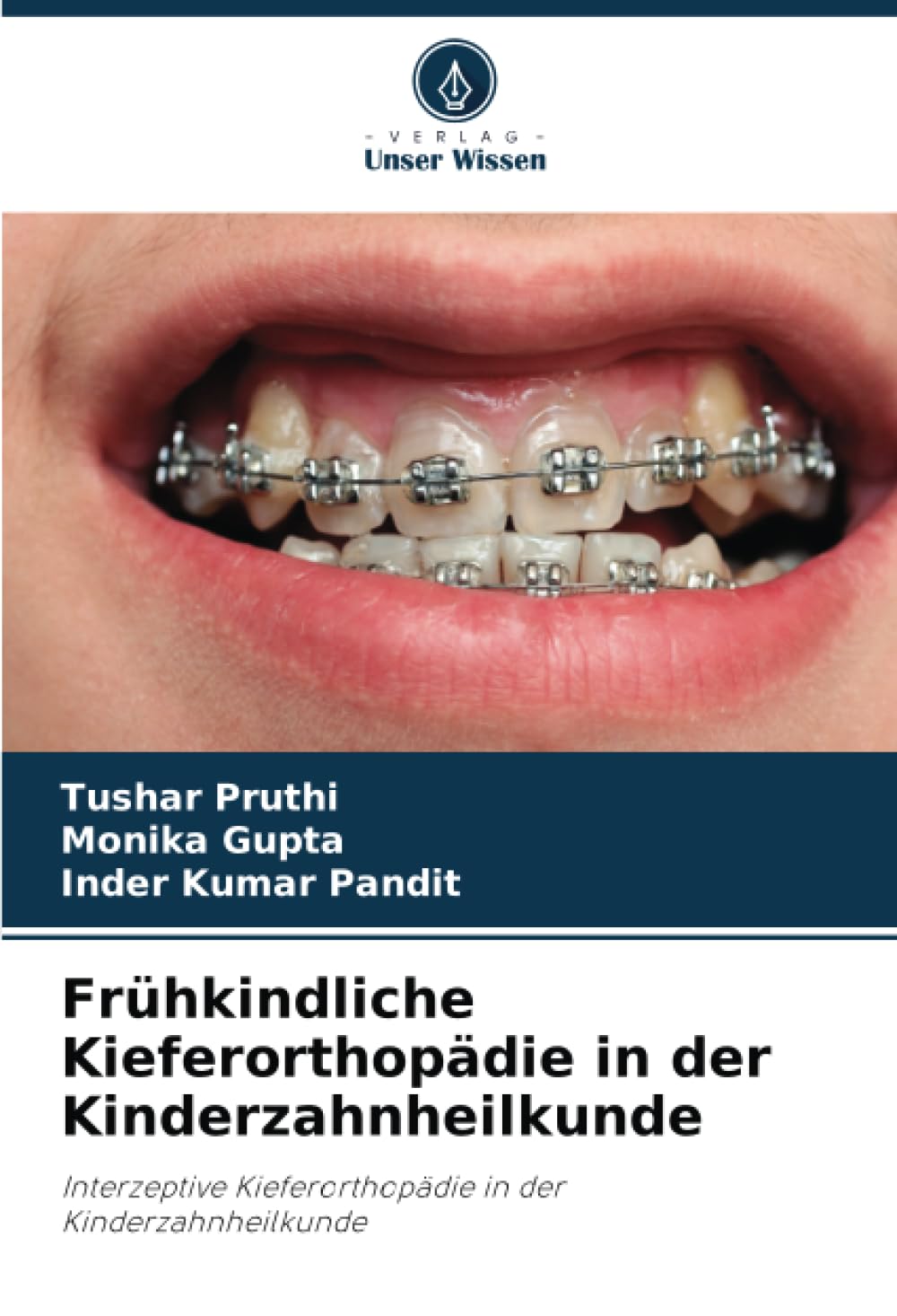 Frühkindliche Kieferorthopädie in der Kinderzahnheilkunde: Interzeptive Kieferorthopädie in der Kinderzahnheilkunde Medicine
