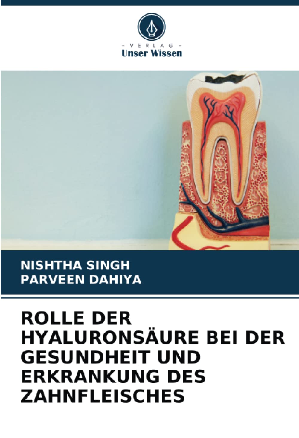 ROLLE DER HYALURONSÄURE BEI DER GESUNDHEIT UND ERKRANKUNG DES ZAHNFLEISCHES Medicine