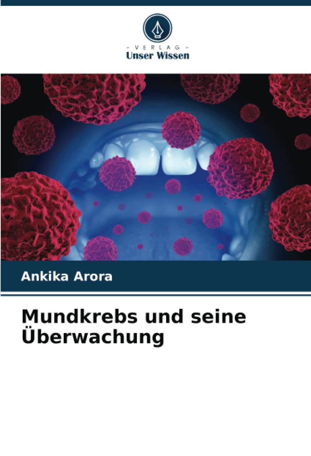 Mundkrebs und seine Überwachung: DE Medicine