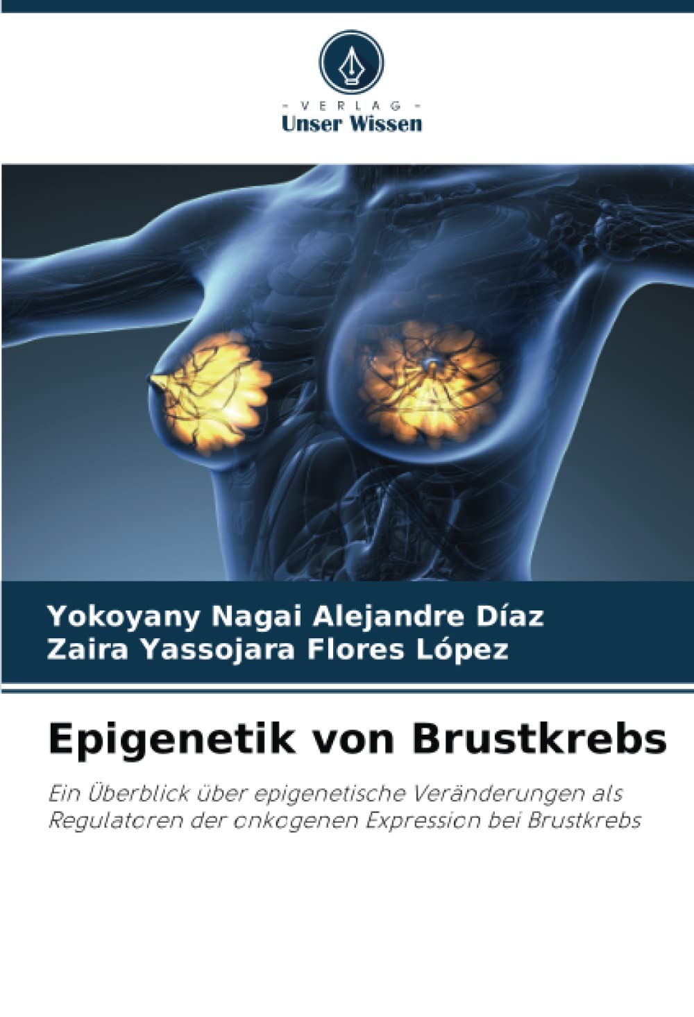 Epigenetik von Brustkrebs: Ein Überblick über epigenetische Veränderungen als Regulatoren der onkogenen Expression bei Brustkrebs Arts & Music
