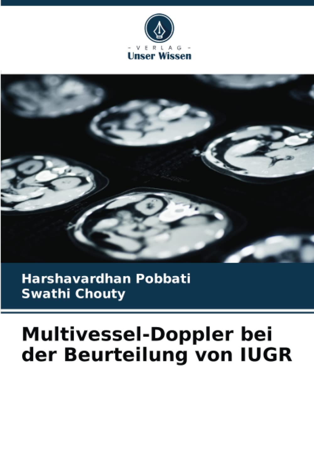 Multivessel-Doppler bei der Beurteilung von IUGR Medicine