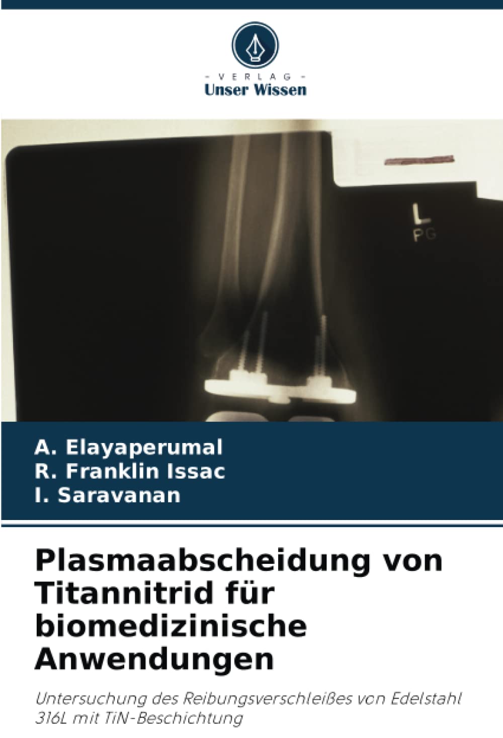 Plasmaabscheidung von Titannitrid für biomedizinische Anwendungen: Untersuchung des Reibungsverschleißes von Edelstahl 316L mit TiN-Beschichtung Business & Technology
