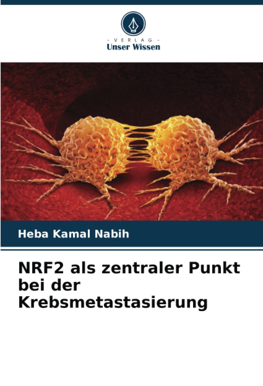 NRF2 als zentraler Punkt bei der Krebsmetastasierung Natural Sciences