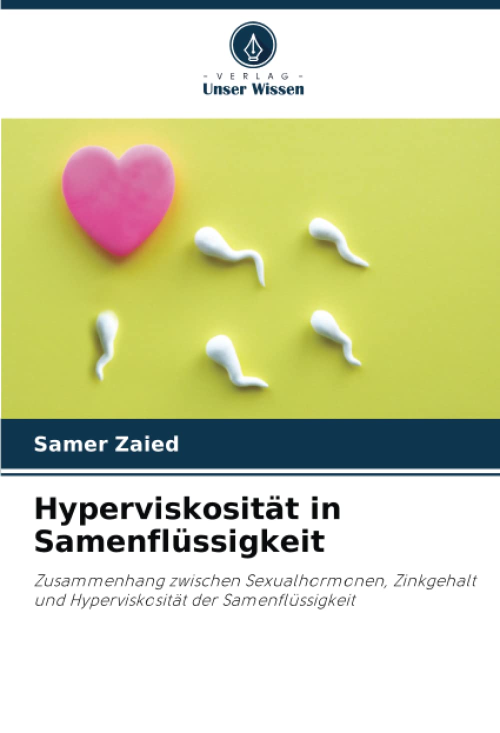 Hyperviskosität in Samenflüssigkeit: Zusammenhang zwischen Sexualhormonen, Zinkgehalt und Hyperviskosität der Samenflüssigkeit Medicine