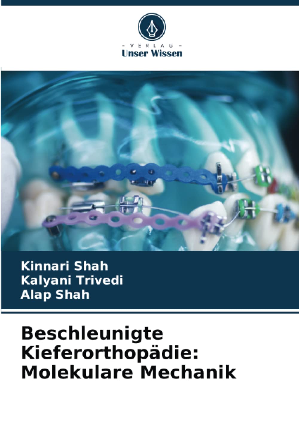 Beschleunigte Kieferorthopädie: Molekulare Mechanik: DE Medicine