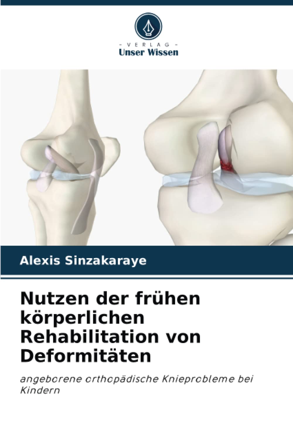 Nutzen der frühen körperlichen Rehabilitation von Deformitäten: angeborene orthopädische Knieprobleme bei Kindern Medicine