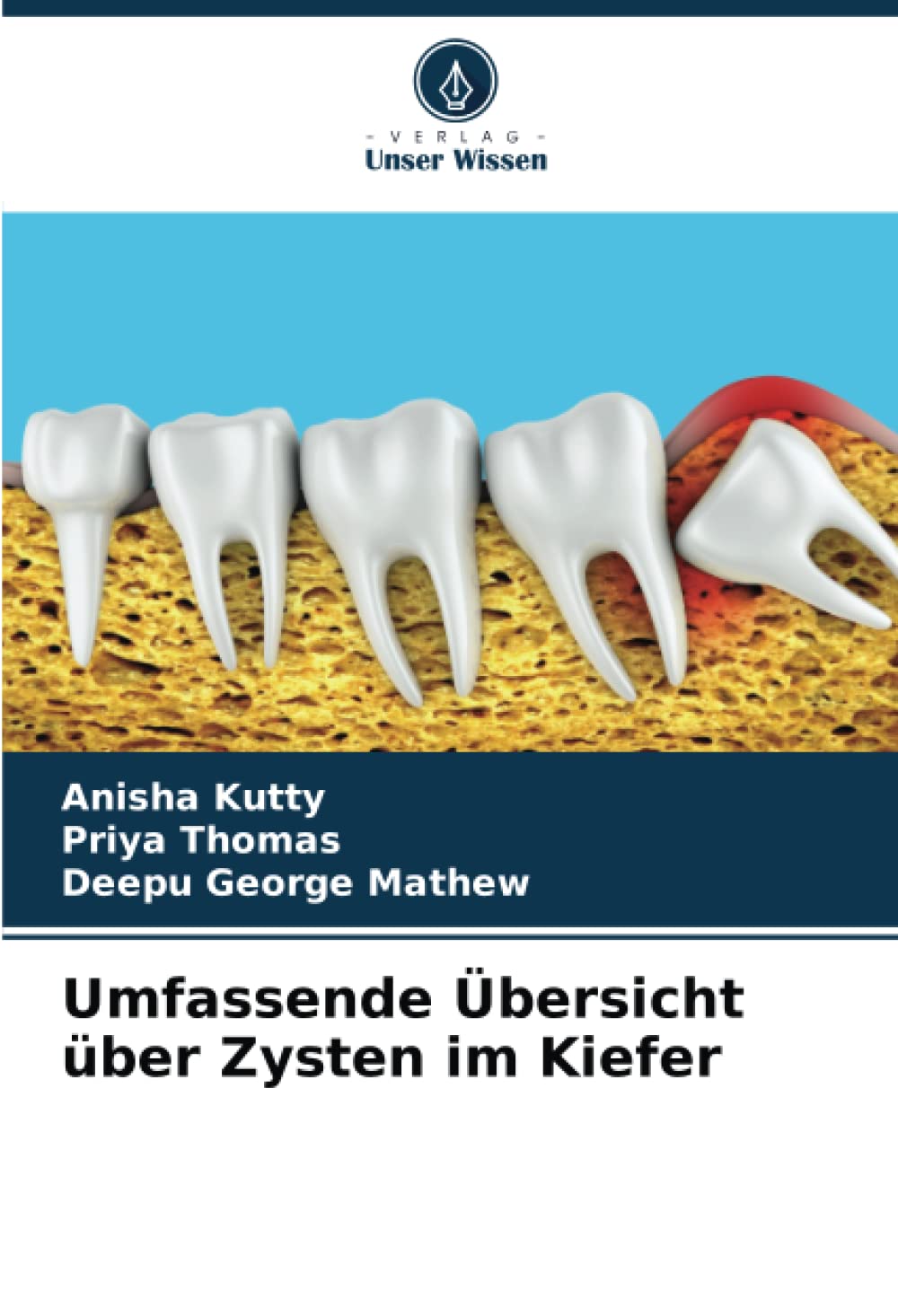 Umfassende Übersicht über Zysten im Kiefer Medicine