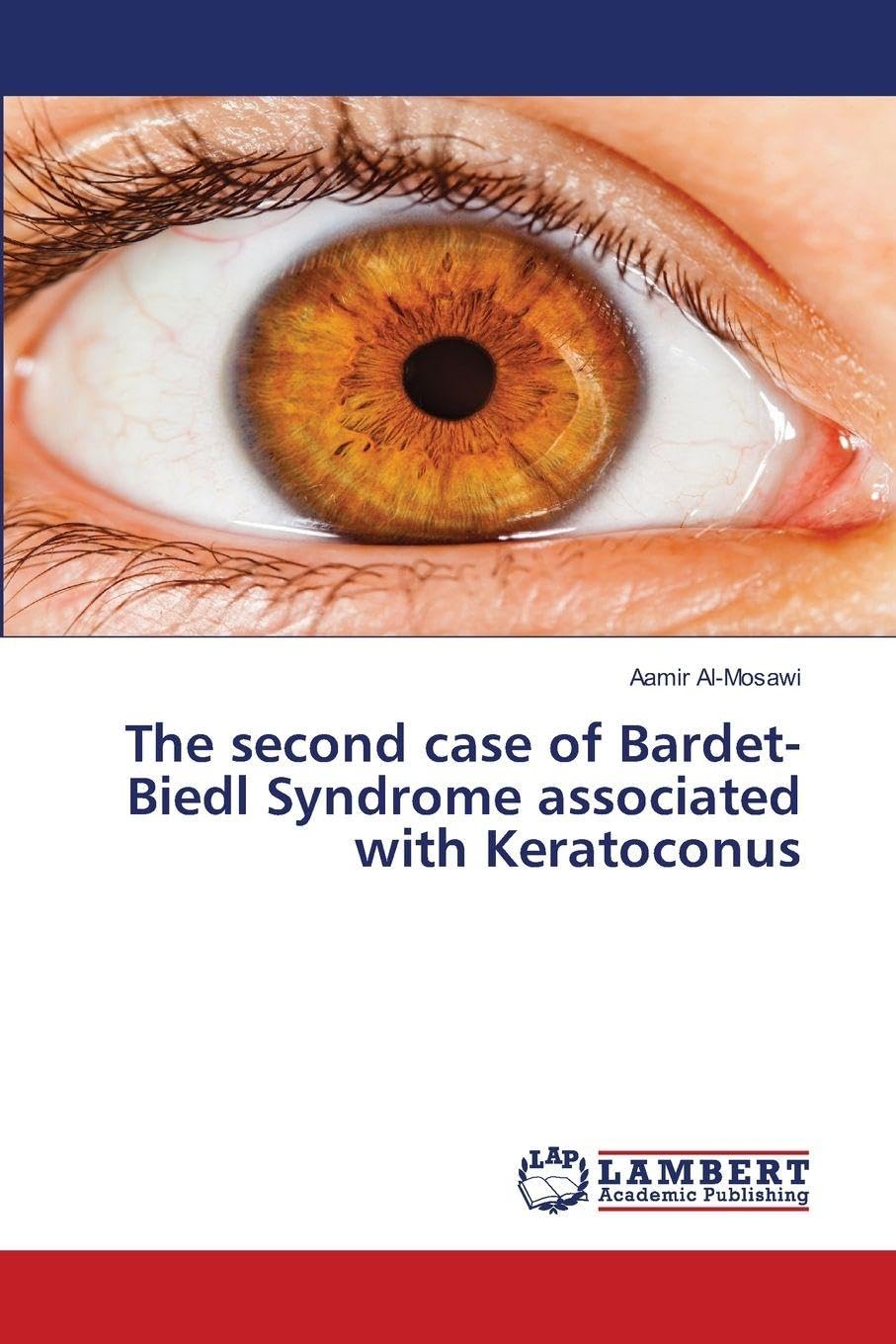 The second case of Bardet-Biedl Syndrome associated with Keratoconus Books