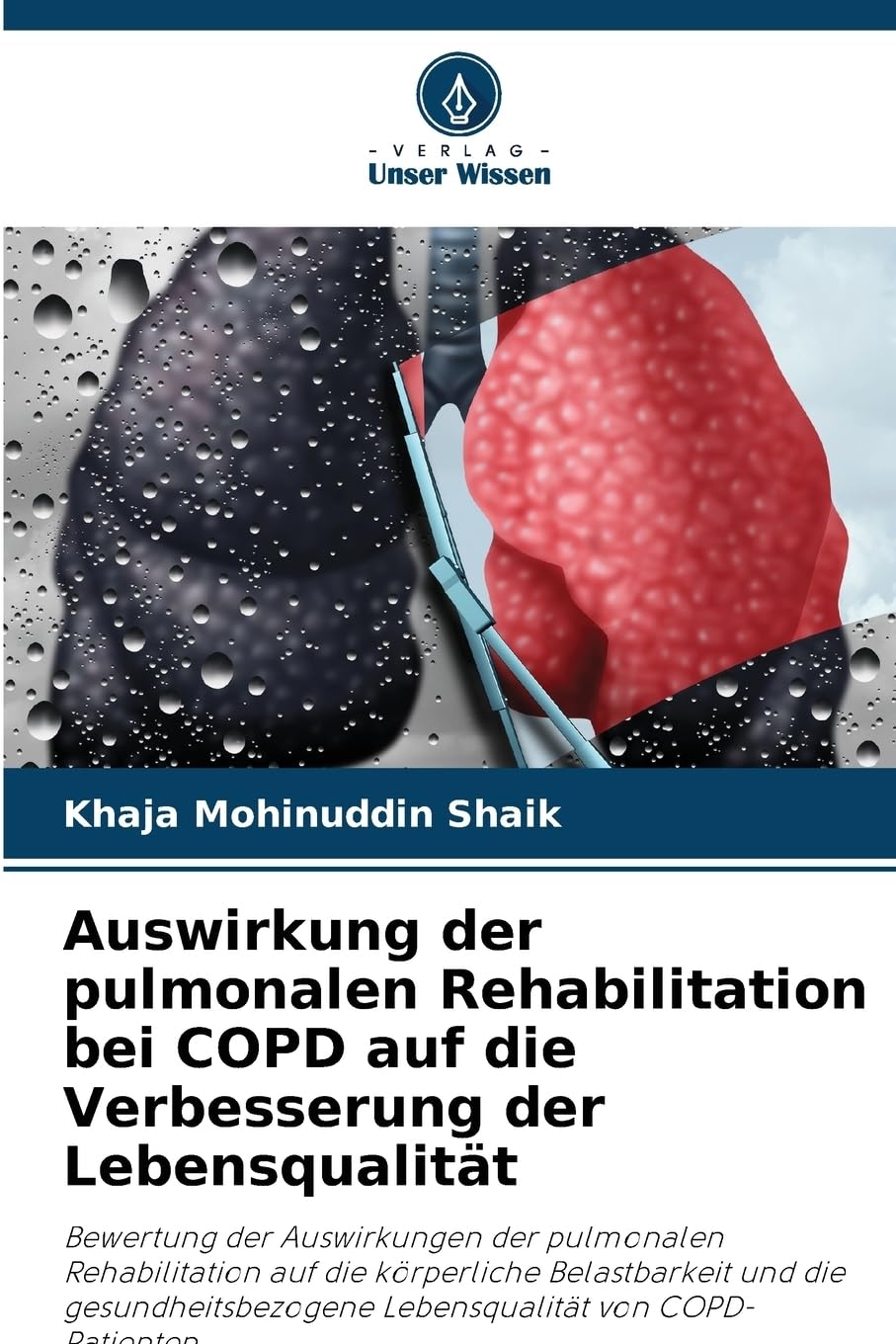 Auswirkung der pulmonalen Rehabilitation bei COPD auf die Verbesserung der Lebensqualität: Bewertung der Auswirkungen der pulmonalen Rehabilitation ... Lebensqualität von COPD-Patienten Medicine