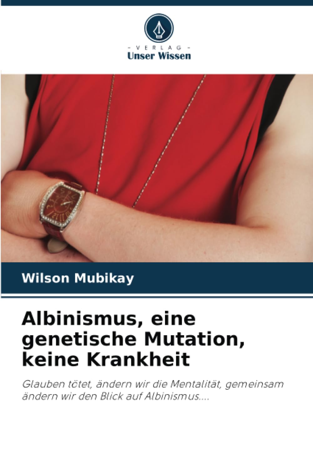 Albinismus, eine genetische Mutation, keine Krankheit: Glauben tötet, ändern wir die Mentalität, gemeinsam ändern wir den Blick auf Albinismus....: ... ändern wir den Blick auf Albinismus.....DE Medicine