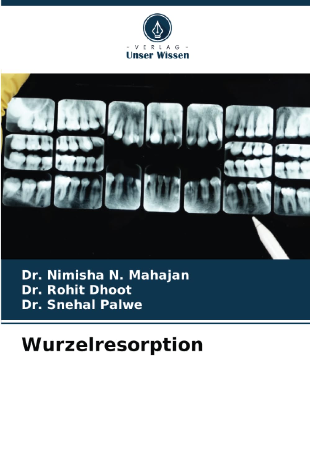 Wurzelresorption: DE Medicine