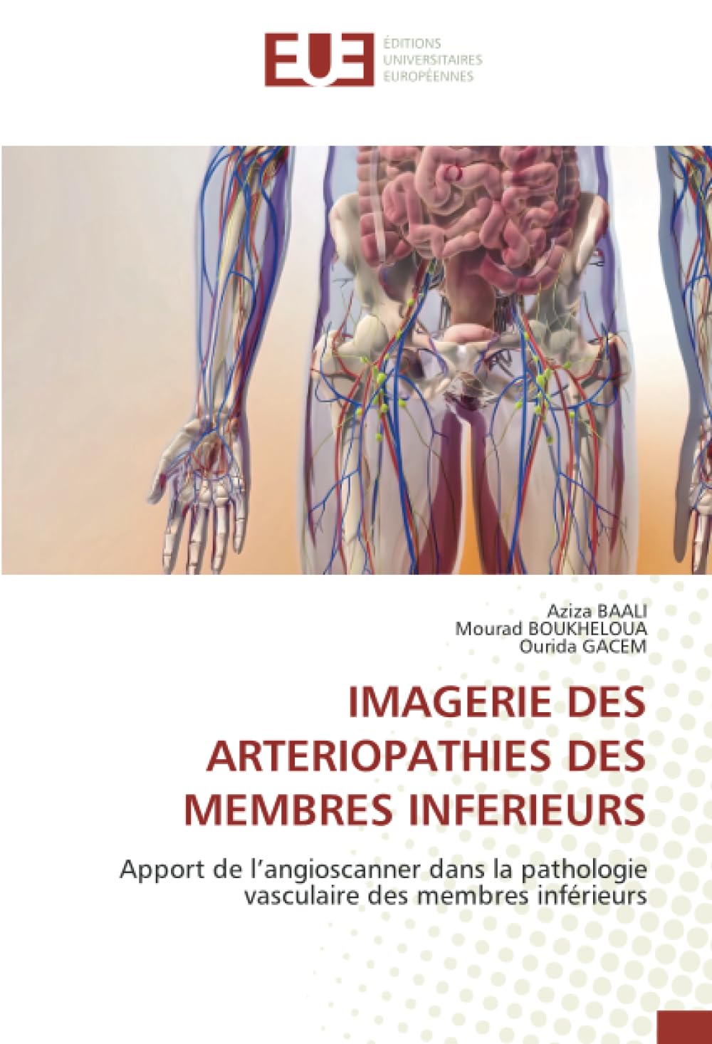 IMAGERIE DES ARTERIOPATHIES DES MEMBRES INFERIEURS: Apport de l’angioscanner dans la pathologie vasculaire des membres inférieurs book