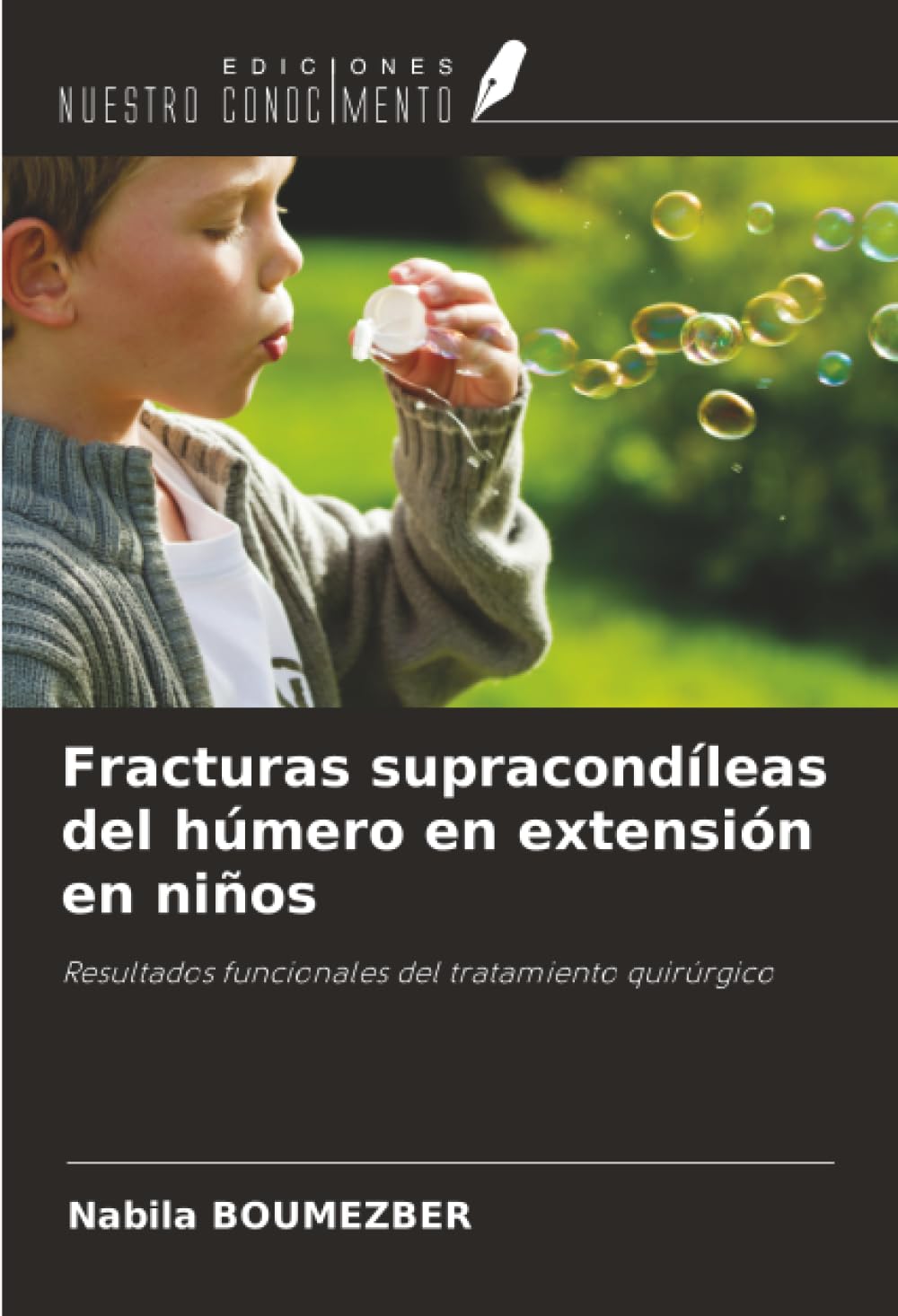 Fracturas supracondíleas del húmero en extensión en niños Medicine