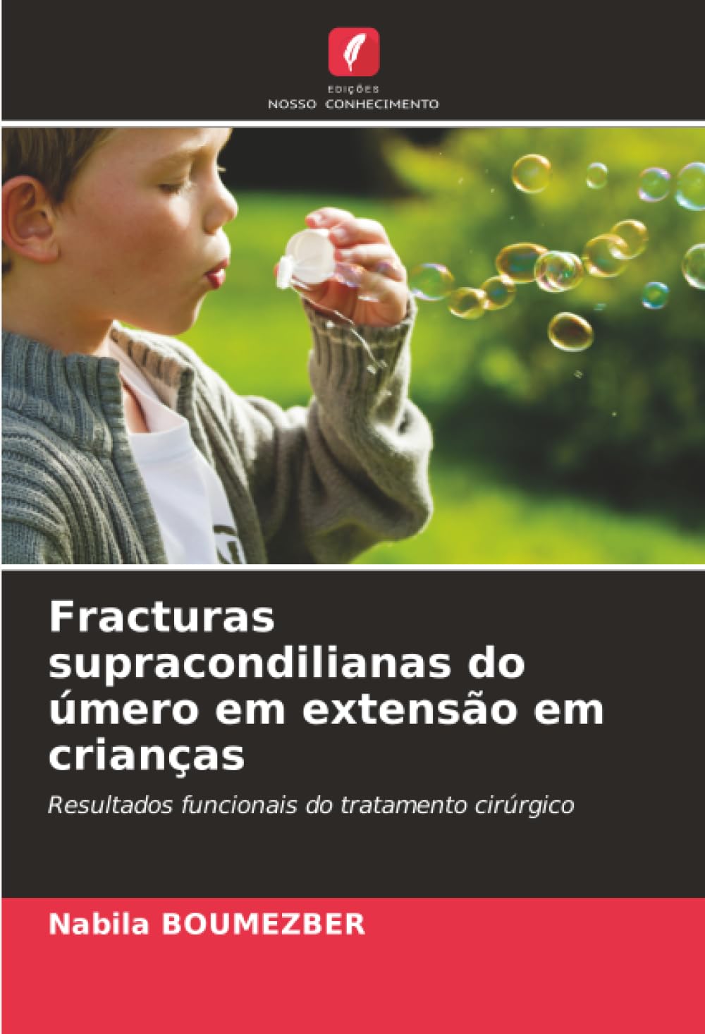 Fracturas supracondilianas do úmero em extensão em crianças Medicine