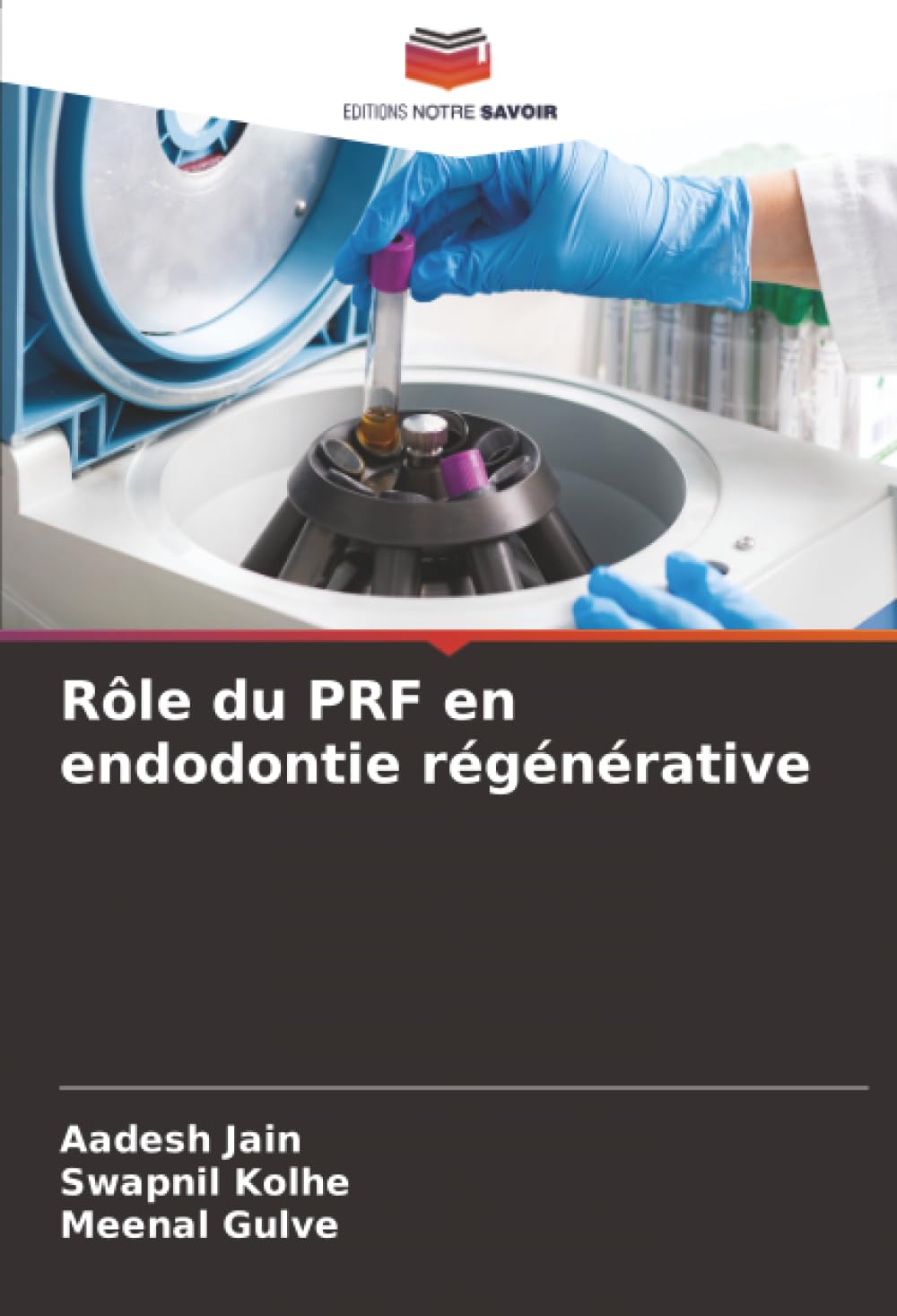 Rôle du PRF en endodontie régénérative Medicine