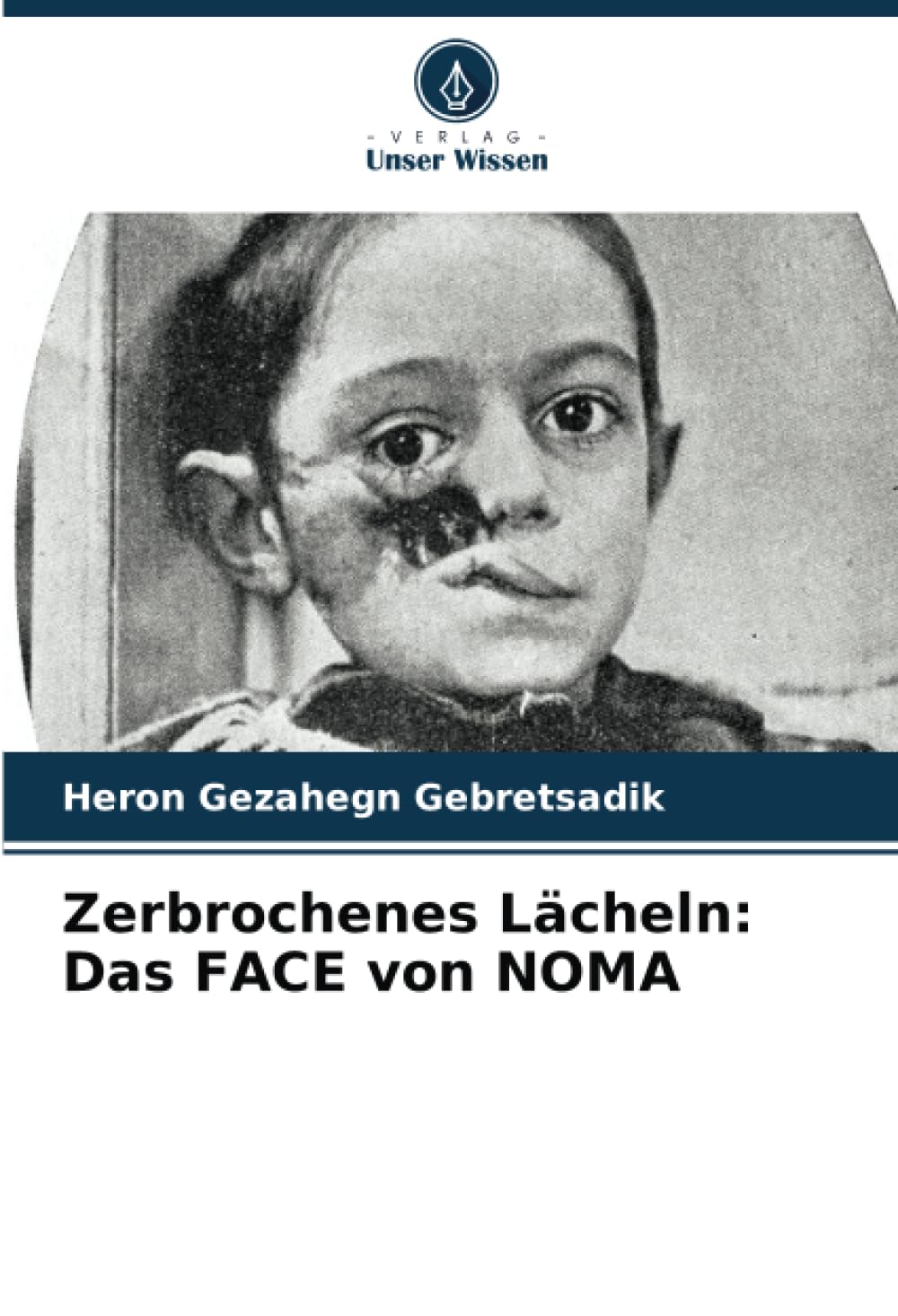 Zerbrochenes Lächeln: Das FACE von NOMA Medicine