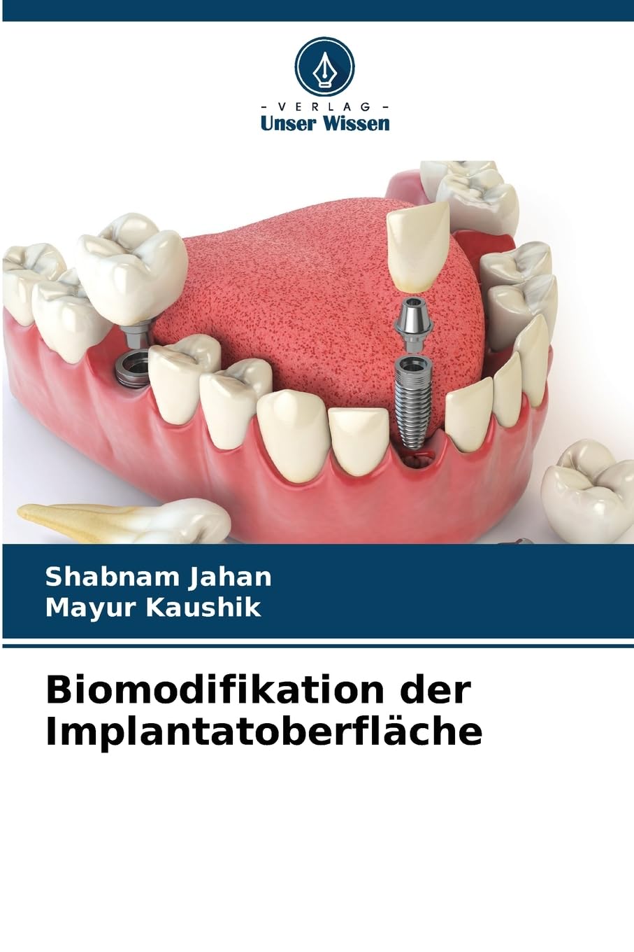 Biomodifikation der Implantatoberfläche Medicine